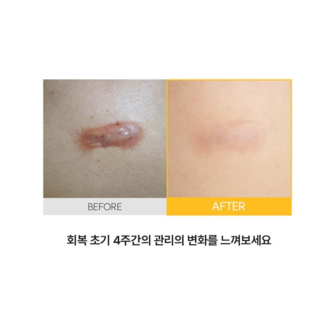 Linuzen Silicone NMN Repair Cream | Silicone Scar Cream, 15ml /Сорвины тос/ - 4